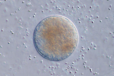Moule - Cellule-oeuf entourée de spermatozoîdes (Mytilus edulis) x125